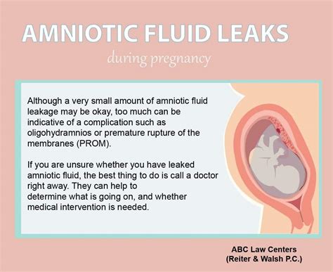 leaking amniotic fluid symptoms|Water Breaking: What Are the Signs of Leaking。